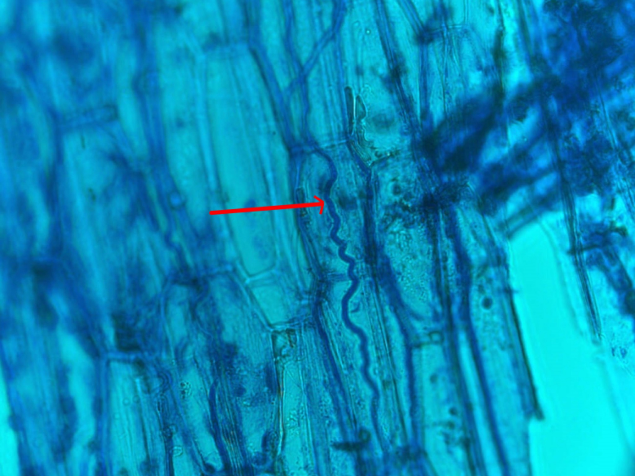 Infektionen mit Epichloë-Pilzen sind in der Regel von außen nicht sichtbar. Der rote Pfeil zeigt auf eine Epichloë-Hyphe zwischen den Pflanzenzellen. Foto: Jochen Krauss